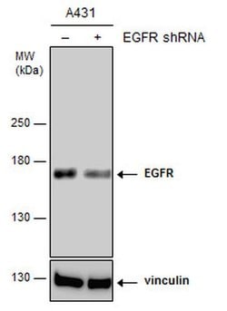 Invitrogen EGFR Polyclonal Antibody 100 &mu;L; Unconjugated:Antistoffer