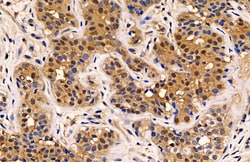 Invitrogen MUC1 Polyclonal Antibody 100 &mu;L; Unconjugated:Antibodies,