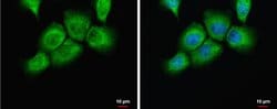 Invitrogen uPAR Polyclonal Antibody 100 &mu;L; Unconjugated:Antibodies,