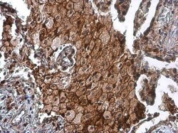 Invitrogen uPAR Polyclonal Antibody 100 &mu;L; Unconjugated:Antibodies,