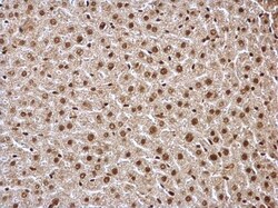 Invitrogen HDAC1 Polyclonal Antibody 100 &mu;L | Buy Online | Invitrogen&trade; | Fisher Scientific