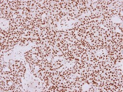 Invitrogen HDAC1 Polyclonal Antibody 100 &mu;L | Buy Online | Invitrogen&trade; | Fisher Scientific