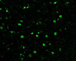 Invitrogen HDAC1 Polyclonal Antibody 100 &mu;L | Buy Online | Invitrogen&trade; | Fisher Scientific