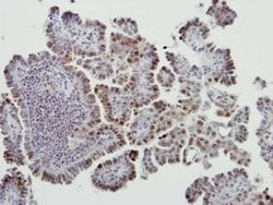 Invitrogen MDM2 Polyclonal Antibody 100 &mu;L; Unconjugated:Antibodies,