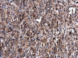 Invitrogen MDM2 Polyclonal Antibody 100 &mu;L; Unconjugated:Antibodies,