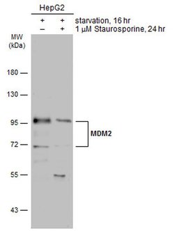 Invitrogen MDM2 Polyclonal Antibody 100 &mu;L; Unconjugated:Antibodies,