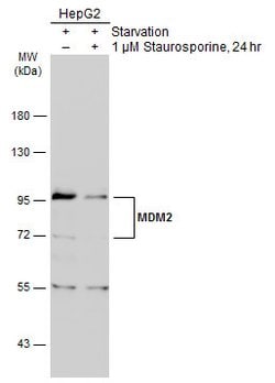 Invitrogen MDM2 Polyclonal Antibody 100 &mu;L; Unconjugated:Antibodies,