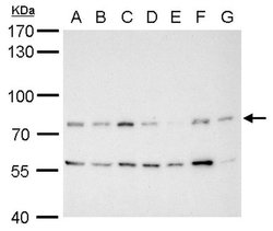 Invitrogen MDM2 Polyclonal Antibody 100 &mu;L; Unconjugated:Antibodies,