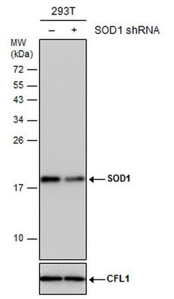 Invitrogen SOD1 Polyclonal Antibody 100 &mu;L; Unconjugated:Antibodies,