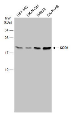 Invitrogen SOD1 Polyclonal Antibody 100 &mu;L; Unconjugated:Antibodies,