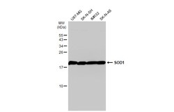 Invitrogen SOD1 Polyclonal Antibody 100 &mu;L; Unconjugated:Antibodies,