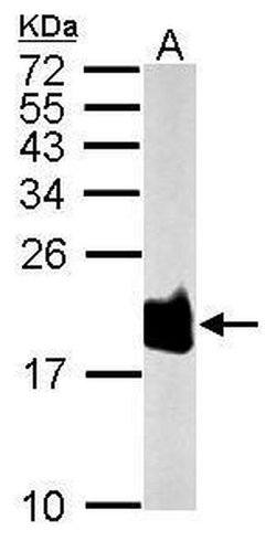 Invitrogen SOD1 Polyclonal Antibody 100 &mu;L; Unconjugated:Antibodies,