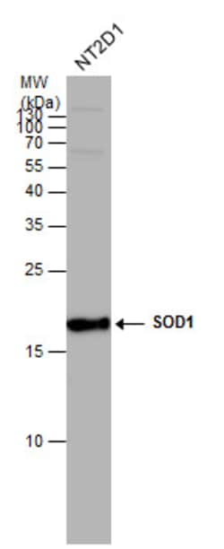 Invitrogen SOD1 Polyclonal Antibody 100 &mu;L; Unconjugated:Antibodies,