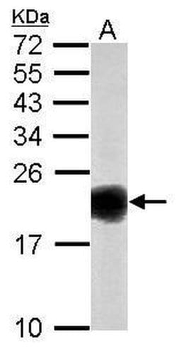 Invitrogen SOD1 Polyclonal Antibody 100 &mu;L; Unconjugated:Antibodies,
