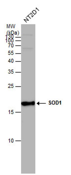 Invitrogen SOD1 Polyclonal Antibody 100 &mu;L; Unconjugated:Antibodies,