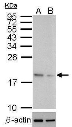 Invitrogen SOD1 Polyclonal Antibody 100 &mu;L; Unconjugated:Antibodies,