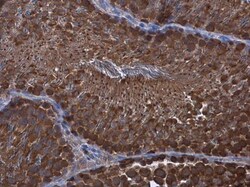 Invitrogen WT1 Polyclonal Antibody 100 &mu;L | Buy Online | Invitrogen&trade; | Fisher Scientific