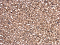 Invitrogen WT1 Polyclonal Antibody 100 &mu;L | Buy Online | Invitrogen&trade; | Fisher Scientific