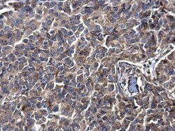 Invitrogen Metadherin Polyclonal Antibody 100 &mu;L | Buy Online | Invitrogen&trade; | Fisher Scientific
