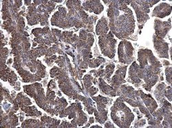 Invitrogen Metadherin Polyclonal Antibody 100 &mu;L | Buy Online | Invitrogen&trade; | Fisher Scientific