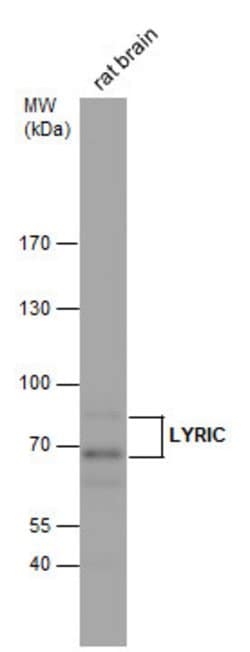 Invitrogen Metadherin Polyclonal Antibody 100 &mu;L | Buy Online | Invitrogen&trade; | Fisher Scientific
