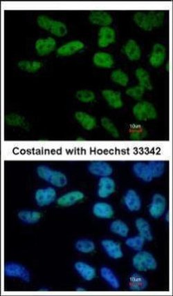 Invitrogen OCT4 Polyclonal Antibody 100 &mu;L; Unconjugated:Antibodies,