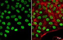 Invitrogen OCT4 Polyclonal Antibody 100 &mu;L; Unconjugated:Antibodies,