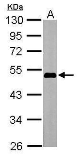 Invitrogen OCT4 Polyclonal Antibody 100 &mu;L; Unconjugated:Antibodies,