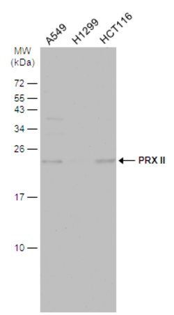 Invitrogen PRDX2 Polyclonal Antibody 100 &mu;L; Unconjugated:Antibodies,