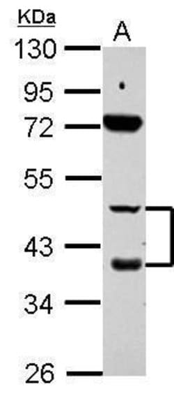Invitrogen RARB Polyclonal Antibody 100 &mu;L | Buy Online | Invitrogen&trade; | Fisher Scientific