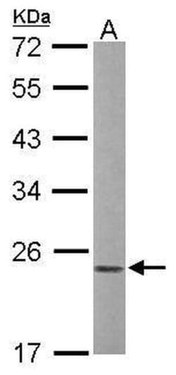 Invitrogen Phospho-RAC1/CDC42 (Ser71) Polyclonal Antibody 100 &mu;L; Unconjugated:Antibodies,