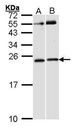 Invitrogen Phospho-RAC1/CDC42 (Ser71) Polyclonal Antibody 100 &mu;L; Unconjugated:Antibodies,