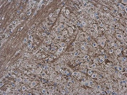 Invitrogen Collagen II Polyclonal Antibody 100 &mu;L; Unconjugated:Antibodies,