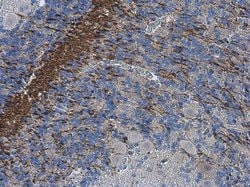 Invitrogen Collagen II Polyclonal Antibody 100 &mu;L; Unconjugated:Antibodies,