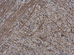 Invitrogen Collagen II Polyclonal Antibody 100 &mu;L; Unconjugated:Antibodies,