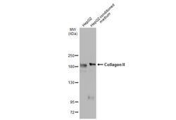 Invitrogen Collagen II Polyclonal Antibody 100 &mu;L; Unconjugated:Antibodies,