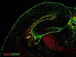 Invitrogen GFAP Polyclonal Antibody 100 &mu;L; Unconjugated:Antibodies,