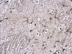 Invitrogen GFAP Polyclonal Antibody 100 &mu;L; Unconjugated:Antibodies,