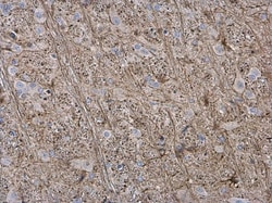Invitrogen GFAP Polyclonal Antibody 100 &mu;L; Unconjugated:Antibodies,