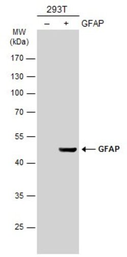 Invitrogen GFAP Polyclonal Antibody 100 &mu;L; Unconjugated:Antibodies,