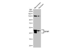 Invitrogen GFAP Polyclonal Antibody 100 &mu;L; Unconjugated:Antibodies,