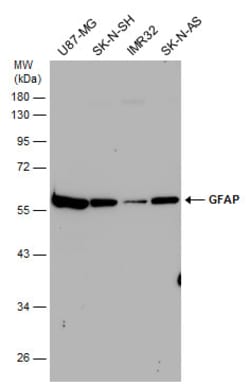Invitrogen GFAP Polyclonal Antibody 100 &mu;L; Unconjugated:Antibodies,