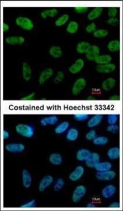 Invitrogen Nanog Polyclonal Antibody 100 &mu;L | Buy Online | Invitrogen&trade; | Fisher Scientific