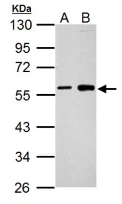 Invitrogen Cyclin B1 Polyclonal Antibody 100 &mu;L | Buy Online | Invitrogen&trade; | Fisher Scientific