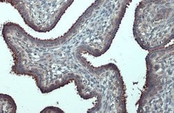 Invitrogen B-Raf Polyclonal Antibody 100 &mu;L; Unconjugated:Antibodies,