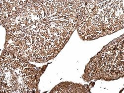 Invitrogen B-Raf Polyclonal Antibody 100 &mu;L; Unconjugated:Antibodies,