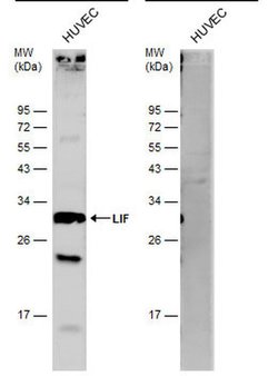 Invitrogen LIF Polyclonal Antibody 100 &mu;L | Buy Online | Invitrogen&trade; | Fisher Scientific