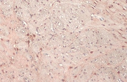 Invitrogen E6AP Polyclonal Antibody 100 &mu;L; Unconjugated:Antibodies,