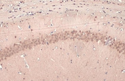 Invitrogen E6AP Polyclonal Antibody 100 &mu;L; Unconjugated:Antibodies,