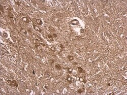 Invitrogen E6AP Polyclonal Antibody 100 &mu;L; Unconjugated:Antibodies,